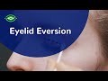 Eyelid Eversion