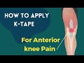 How to apply Kinesiology tape for knee pain - Patella Femoral Syndrome / Osgood Schlatters Syndrome