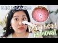 Blackhead Vacuum w/ BUILT IN CAMERA! ( SOBRANG SAYA LANG! ) | Kris Lumagui