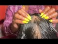 ASMR Hair Scratch Sounds That Will Give You Tingles(no talking)