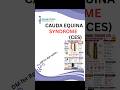 Cauda EQUINA Syndrome #physiotherapy #healthcare #physiohub #physionotes