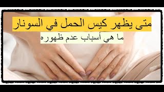 متى يظهر كيس الحمل - متى يظهر كيس الحمل في السونار؟ وما هي أسباب عدم ظهوره