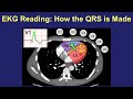 EKG Reading: How the QRS is Made