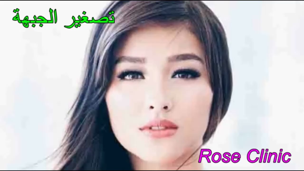 تصغير الجبهة سبليمنال مضاعف التأثير