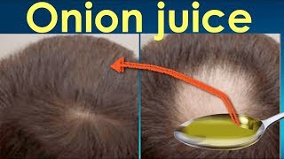 How to use Onion Juice and Neem water for hair growth