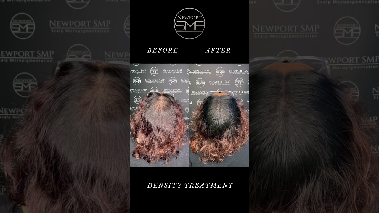 Woman SMP Density Dark Hair - Redefine the Mirror Moment