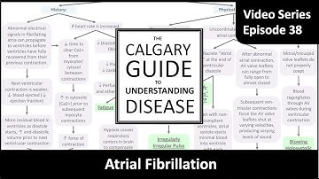 Atrial Fibrillation