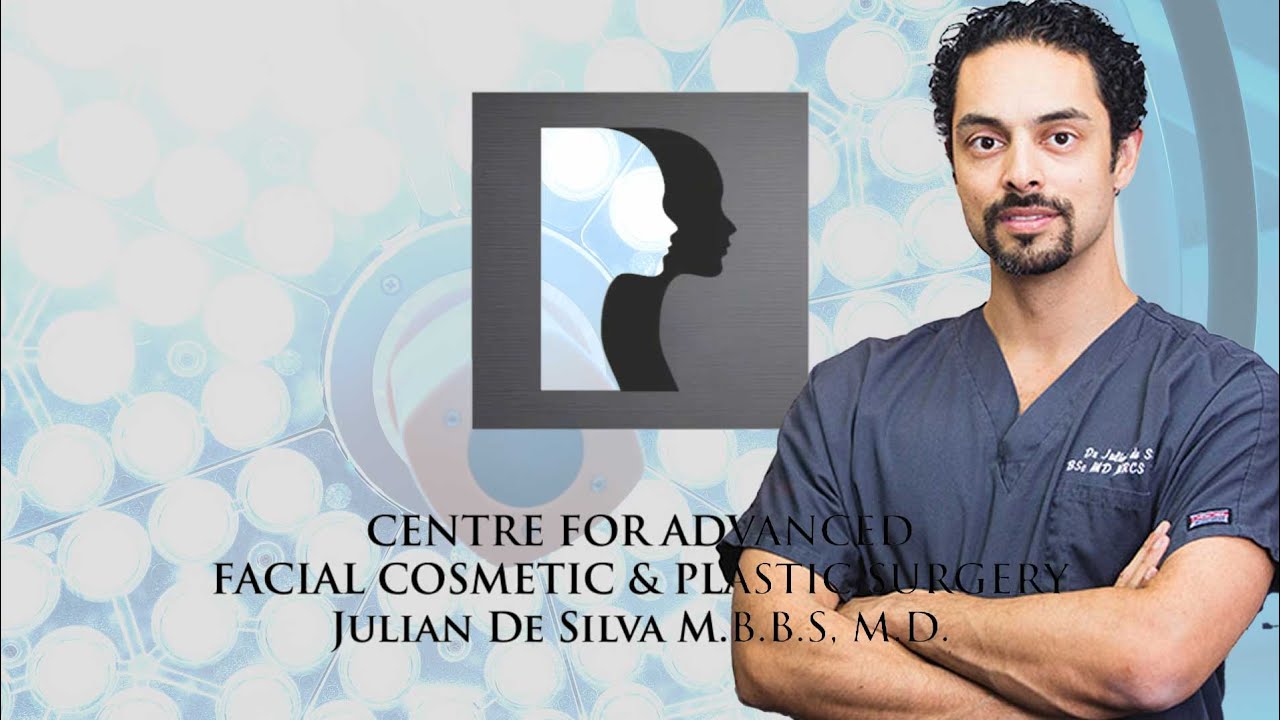 Real Patient Eyelift Results - Blepharoplasty - Dr. De Silva