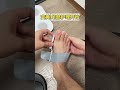 Adjustable Bunion Corrector Splint for Toe Alignment &amp; Foot Pain Relief