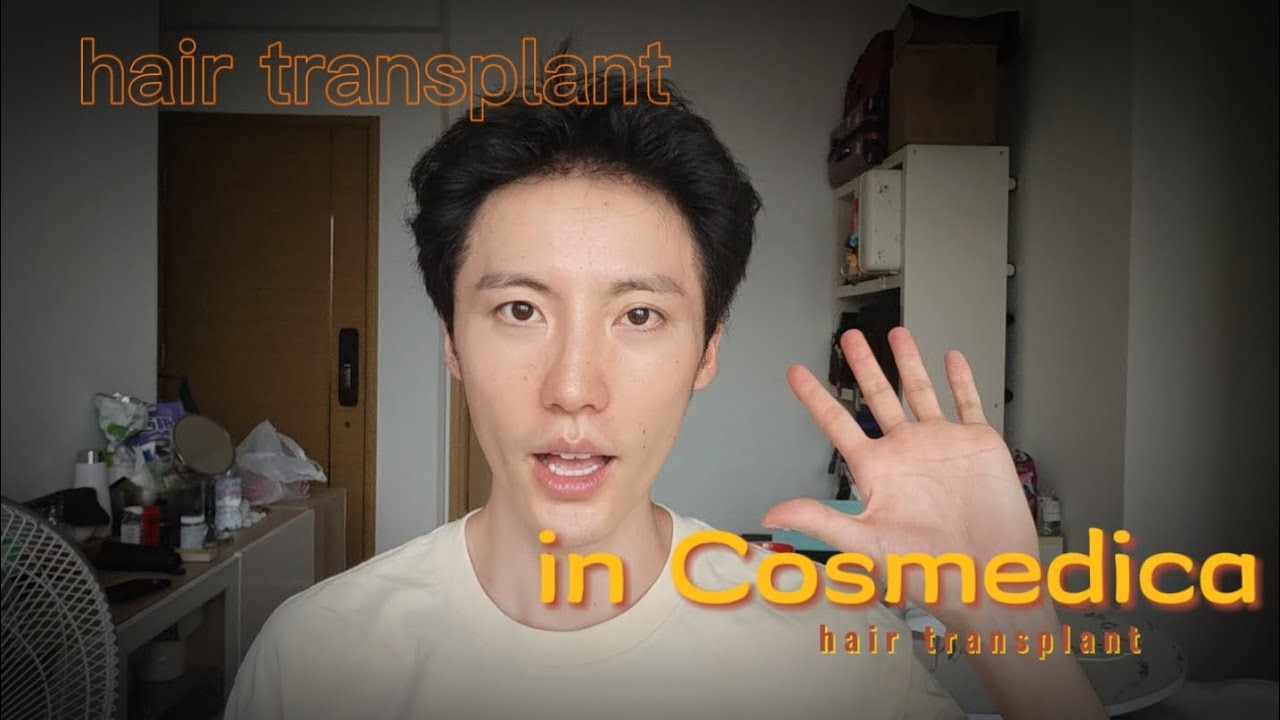 Hair transplant in Cosmedica Clinic, month 8 #cosmedicaclinic #hair #