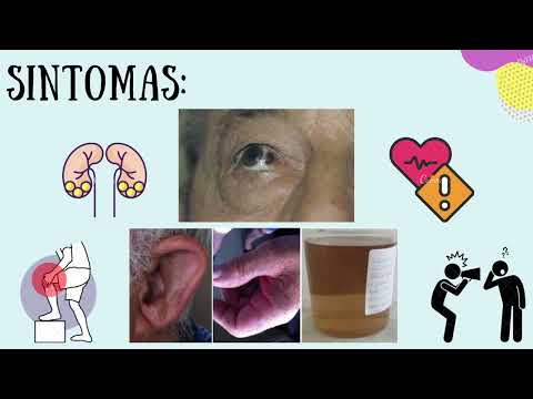 Vídeo: O que é a patologia da alcaptonúria?