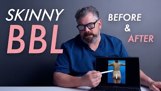 Skinny Bbl Results - Before And After