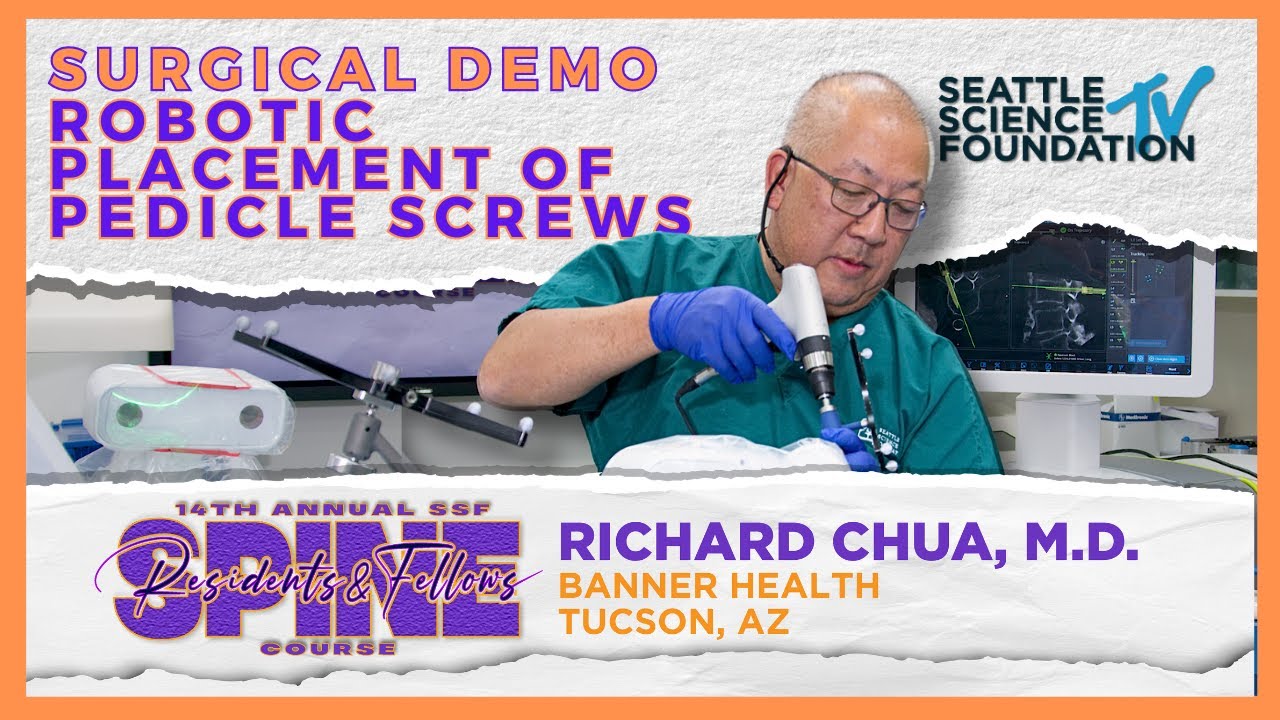 Robotic Placement of Pedicle Screws - Richard Chua, M.D.