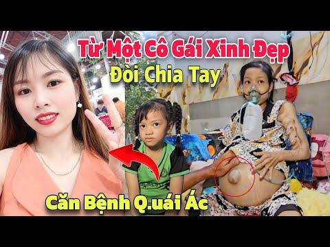 Từ Một Cô Gái Xinh Đẹp 32.T Bụng Phình To, Mắc Bệnh Phải Cầu C.ứu Không Tiền Đi Viện.