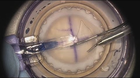 CORONET Surgical Trainer & DMEK & DSAEK EndoGlide