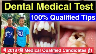 Dental Medical Test Check  Sscgd Dental Medical Test  Indian Army Dental Medical Test
