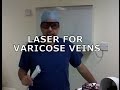 Laser for varicose veins explanation and demonstration evl evlt