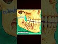 #  Ameloblastoma - easy and clear concept with tooth talks with dr Sandhu 🦷🦷💫