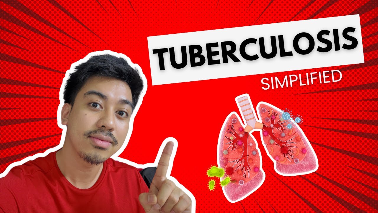 Tuberculosis: Signs and symptoms, Medications and Nursing Management | PNLE 2025