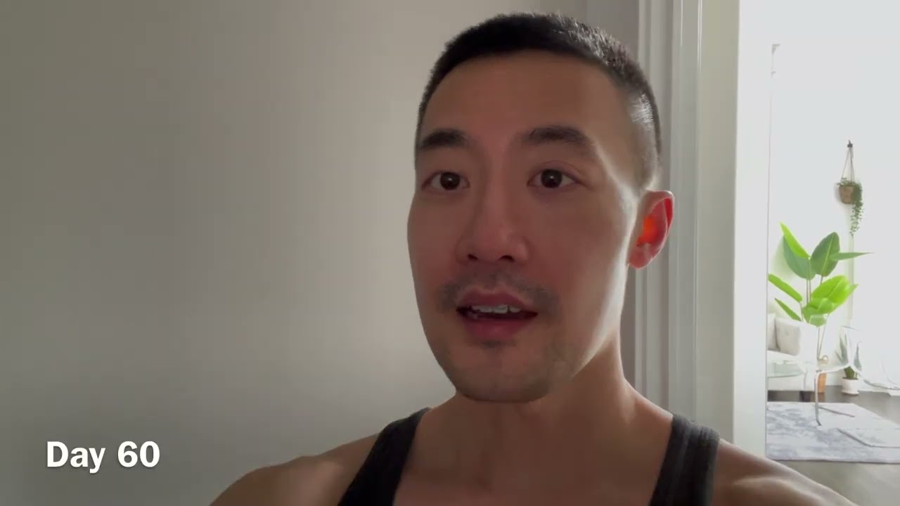 UNDERBITE DOUBLE JAW SURGERY VLOG 28 Week 9 Recovery How Much Time