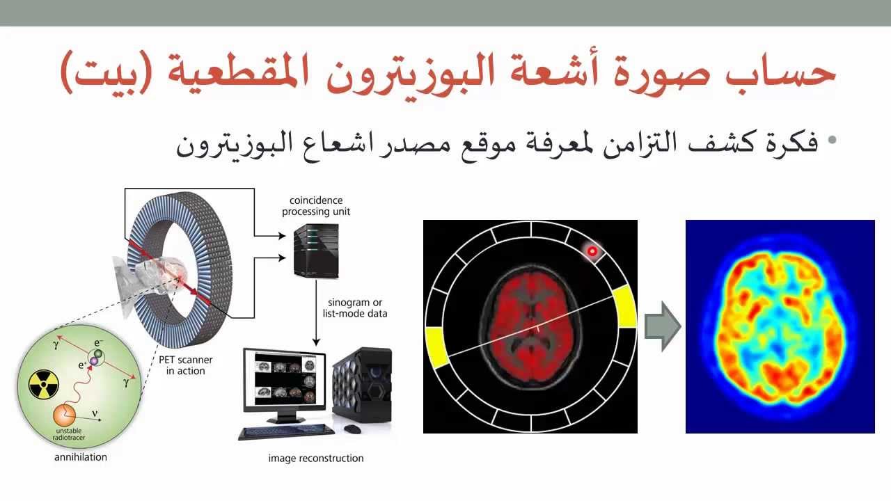 التصوير الطبي 18: فكرة عمل التصوير بالأشعة المقطعية
