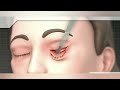 All You Need To Know About Blepheroplasty | Patient Educational Video Series | Dr Varun Nambiar