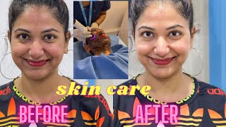 Skin Care | After Travel SkinCare Routine |DermaVue