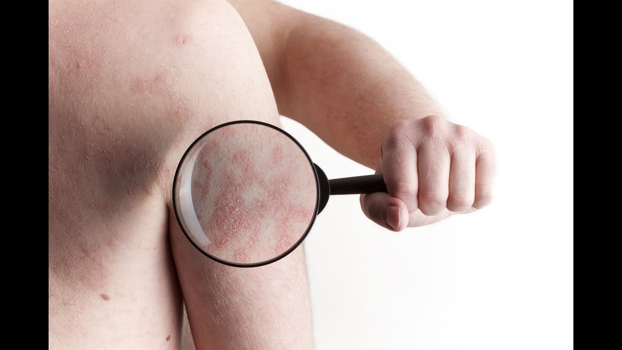 Extrait formation E-learning - Diagnostic dermatologique