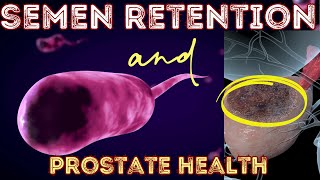 The Surprising Link: Semen Retention and Prostate Cancer Prevention Semen Retention Keeping The Prostate Healthy Without Ejaculating