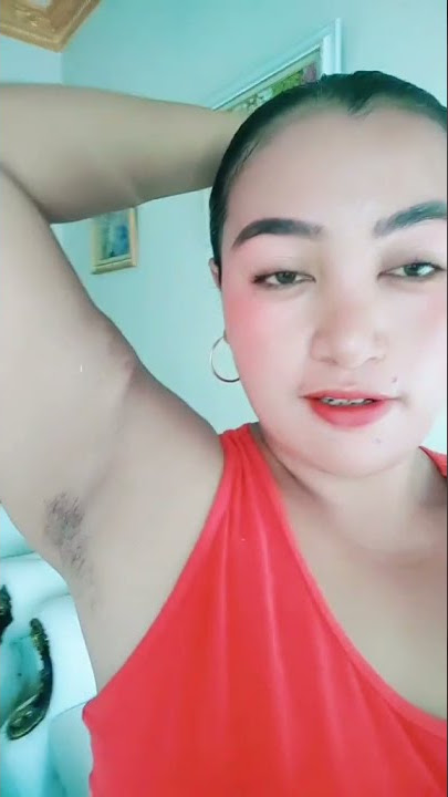 ketek berkeringat