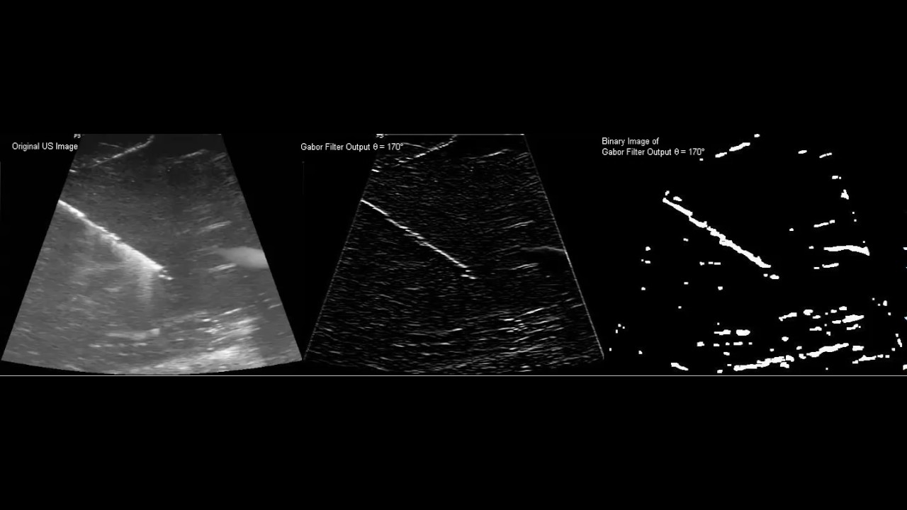ICRA2014 - Visual tracking of biopsy needles in 2D ultrasound images