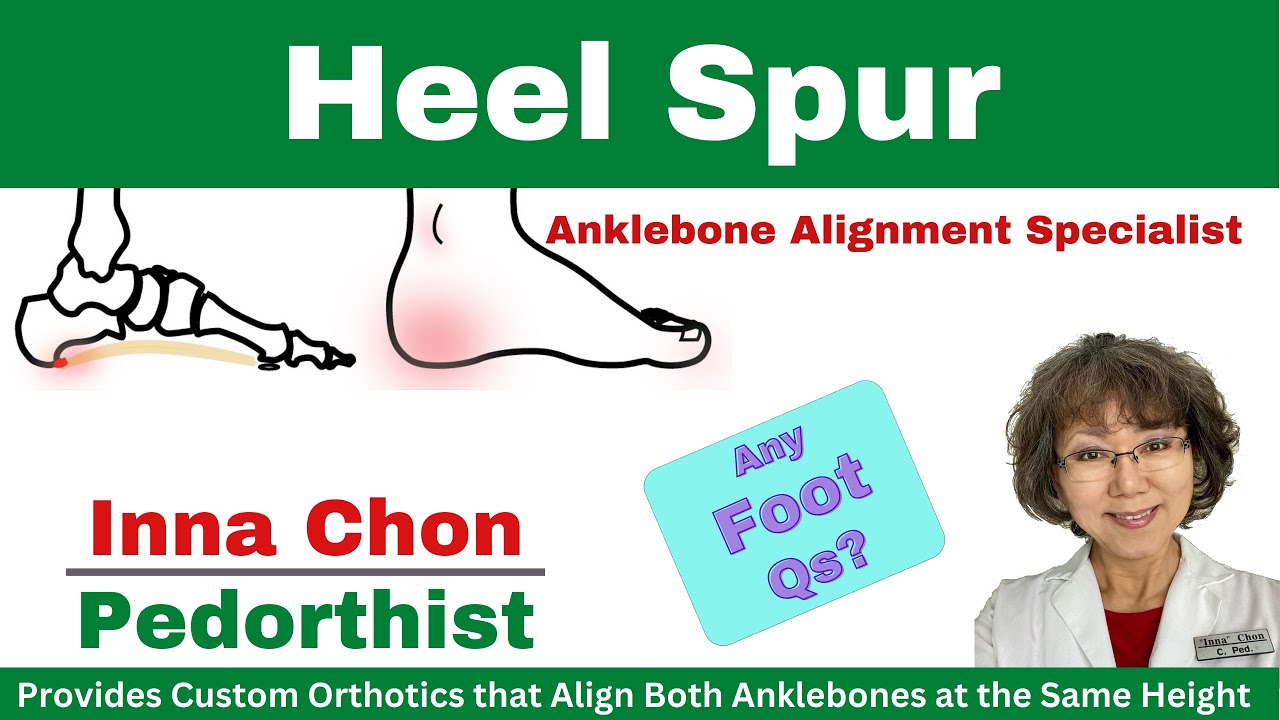 Heel Spur, Its Cause, How to get Rid of the Pain & Be Healed w ...