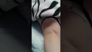 Депиляция подмышечной впадины воском Депиляция подмышечной впадины воском