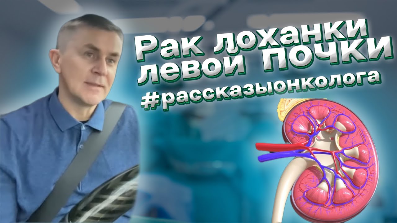 Рак лоханки левой почки. Рак верхних мочевыводящих путей ...