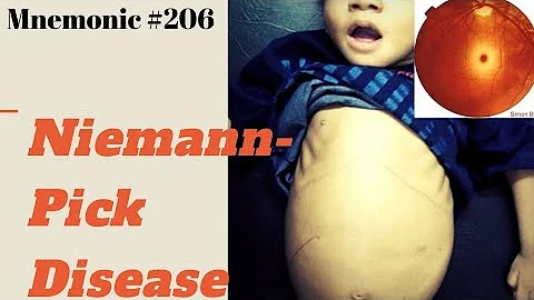 Niemann-Pick disease mnemonic for USMLE Step 1