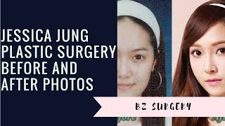 Jessica Jung Plastic Surgery Before and After Photos