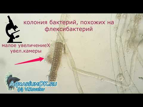 Как выглядит сапролегниоз (Saprolegniasis) рыбы под микроскопом. Зооспорангии и зооспоры.