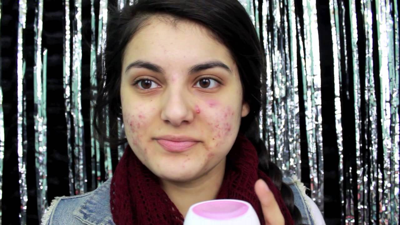 Skin Update #1: Spironolactone, Emotional Rant | Amy Ali