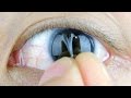 How to Easily Remove Contacts V2 | BeatTheBush DIY