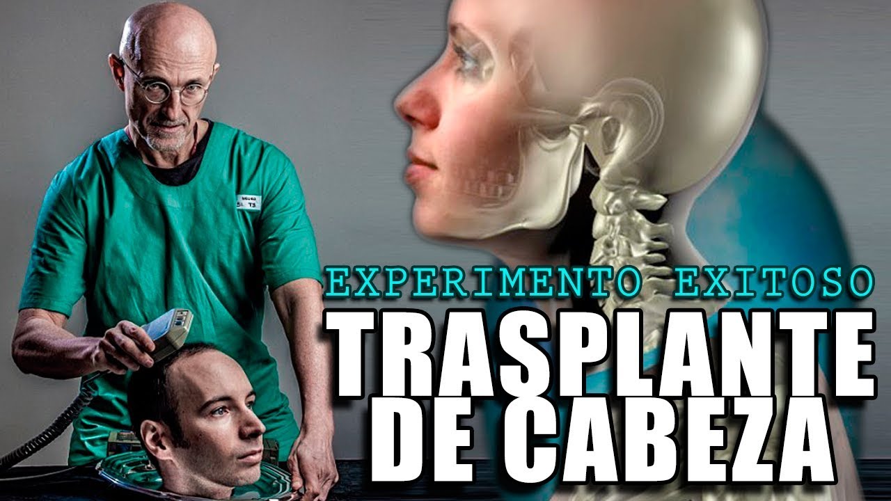 INMORTALIDAD. PRIMER TRASPLANTE DE CABEZA DE UN SER HUMANO | SERGIO CANAVERO. NEUROCIRUJANO