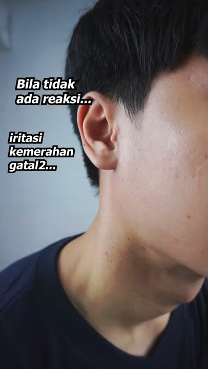 Cara Tau Skincare Cocok atau Ngga KE WAJAHMU