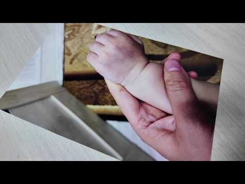Bruises, a broken arm, and a cold balcony: parents allege child abuse at a daycare...