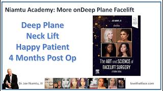 Deep Plane Facelift 4 Months Later: Happy patient and Happy Surgeon