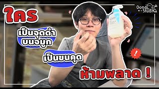 อยากรักษาจุดดำบนจมูกและขนคุดห้ามพลาด