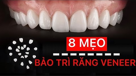 8 mẹo bảo trì răng veneer | Tt niềng răng quốc tế Diamond