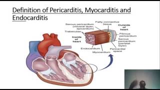 LEARN ABOUT PERICARDITIS, MYOCARDITIS AND ENDOCARDITIS