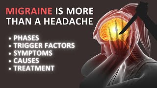 What Is Migraine | Migraine Headaches Relief | Urdu/Hindi