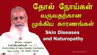 தோல் நோய்கள் வருவதற்கான முக்கிய காரணங்கள் | Common Skin diseases and Nature cure