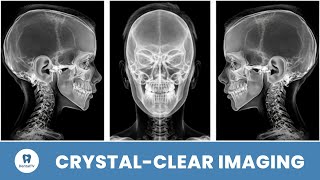Revolutionizing Medical Imaging: Breakthrough in Nuclear Medicine