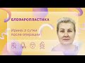 Ирина. Блефаропластика. 2 сутки после операции